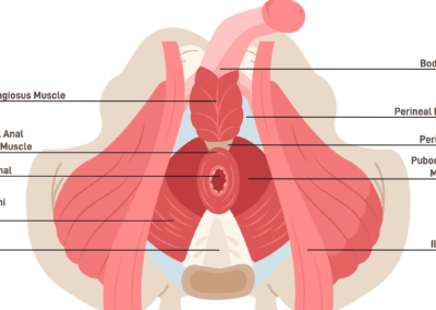 understanding pelvic floor therapy in prostate cancer