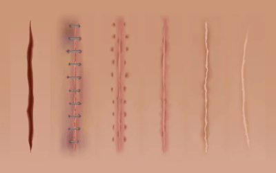 Why Does My Scar Hurt?